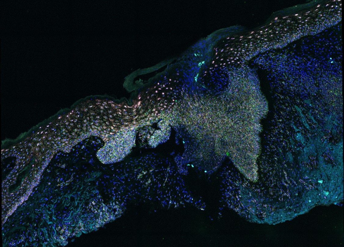 RNA scope image of skin biopsy