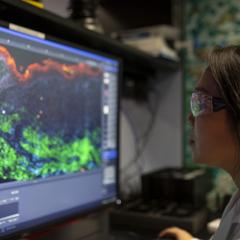 Spatial transcriptomics imaging